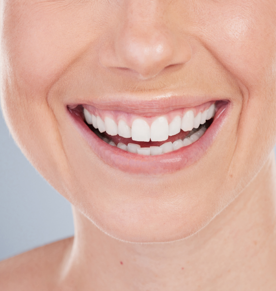 Smiling woman outside with healthy teeth